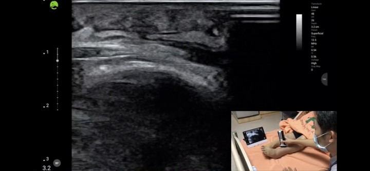 台大醫院與台北市立聯合醫院中興院區4日舉辦「跨院遠距通訊診療」線上記者會，雙方將強化合作，中興院區醫師可透過即時超音波與台大醫院醫師共同會診。（台大醫院提供）