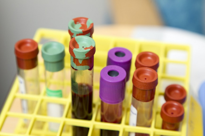 Taiwan-developed COVID drug trial shows positive clinical results