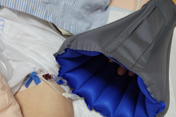 奇美醫學中心醫護團隊研發取代傳統約束工具的「手/守護氣圈」，在院內病房使用後評估成效良好。（奇美醫學中心提供）