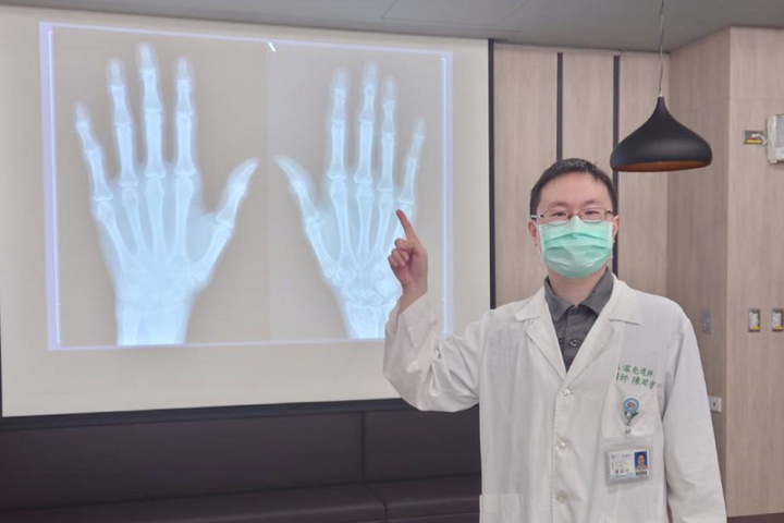 奇美醫學中心風濕免疫科主治醫師陳昭宇（圖）在院內衛教宣導會表示，手部退化性關節炎若能早期發現，配合藥物及非藥物治療，大多可得到很好的控制與症狀改善。