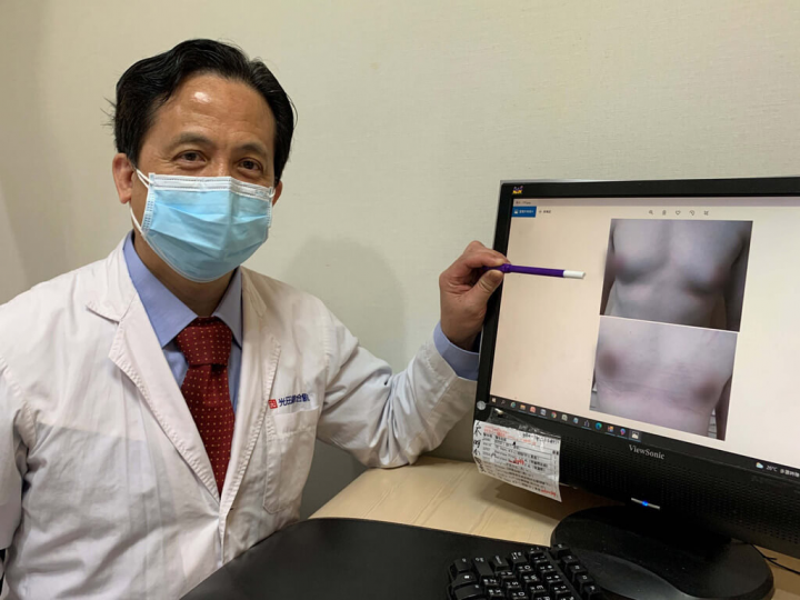 體重近百公斤的陳先生，減重後胸前依然雄偉，檢查才知罹患「男性女乳症」，光田綜合醫院整形外科主任吳文宏（圖）表示，現在男性女乳症手術傷口小恢復快，患者不必怕開刀。（光田綜合醫院提供）