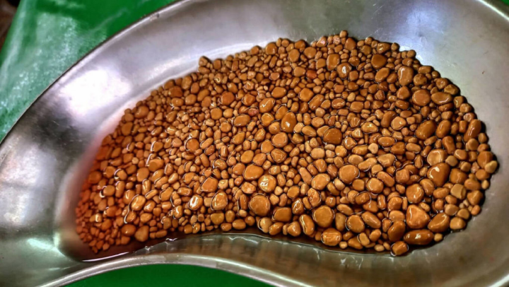 嘉義8旬老翁排尿困難掛泌尿科門診，經醫師檢查發現膀胱塞滿結石，並帶有多重抗藥性細菌，近日以內視鏡清出大小結石近千顆（圖）。（黃才倍提供）