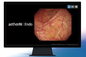 「大腸鏡即時AI瘜肉偵測 aetherAI Endo」為國內首項智慧醫材認證。(台大醫院提供)