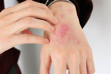 愛滋病毒就在你我身邊 提高警覺主導自我健康權