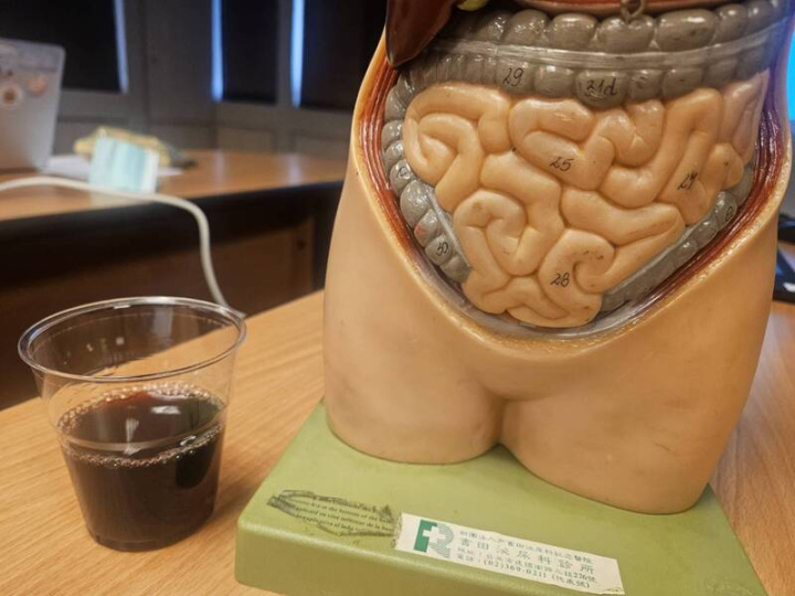 60多歲許小姐有高血壓及糖尿病，因慢性腎病定期洗腎多年，最近1個月間歇性血便，甚至大便色深如葡萄酒，嚇得以為大腸癌，到門診透過大腸鏡檢查才知是血管異常增生造成。圖為示意圖。