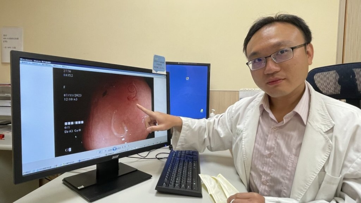 南投縣70歲張姓男子退休後常赤腳在住家附近田裡走動，66歲李姓婦人常上山赤腳溯溪，2人日前腹痛就醫，亞洲大學附屬醫院醫師江承源（圖）在腸道發現白色條狀物，化驗後確認為十二指腸鉤蟲，經藥物治療才康復。醫師也提醒，民眾到野外務必穿鞋，降低鉤蟲入侵體內的風險。（亞大醫院提供）