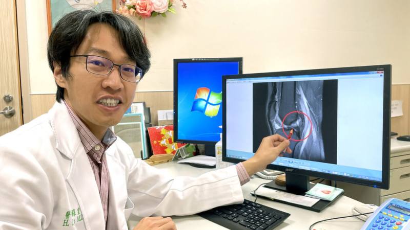 前十字韌帶撕裂是常見的運動傷害疾病之一，亞洲大學附屬醫院骨科部主治醫師蘇皇儒建議，藉由「前十字韌帶重建合併前外韌帶固定術」可增加膝蓋穩定度，重新找回運動力。（亞大醫院提供）