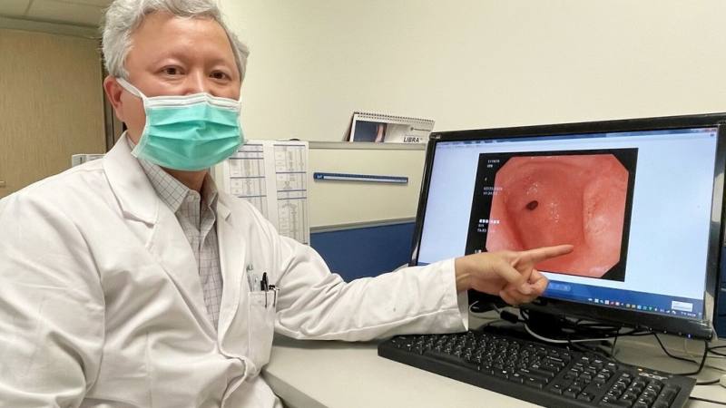 亞洲大學附屬醫院一般外科主治醫師林裕強（圖）指出，國人癌症發生率中，胃癌排名第10位，胃癌危險因子十分多元，包括幽門螺旋桿菌、家族遺傳、年齡老化、抽菸喝酒、不健康飲食等，都是致癌高風險群。（亞大醫院提供）