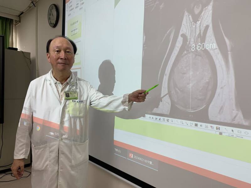 衛生福利部台中醫院舉辦衛教宣導記者會，泌尿科主任朱朗軒（圖）表示，男性睪丸變大，有可能是睪丸發炎、陰囊水腫或是睪丸癌等原因，只要發現腫大就要注意。（衛福部台中醫院提供）