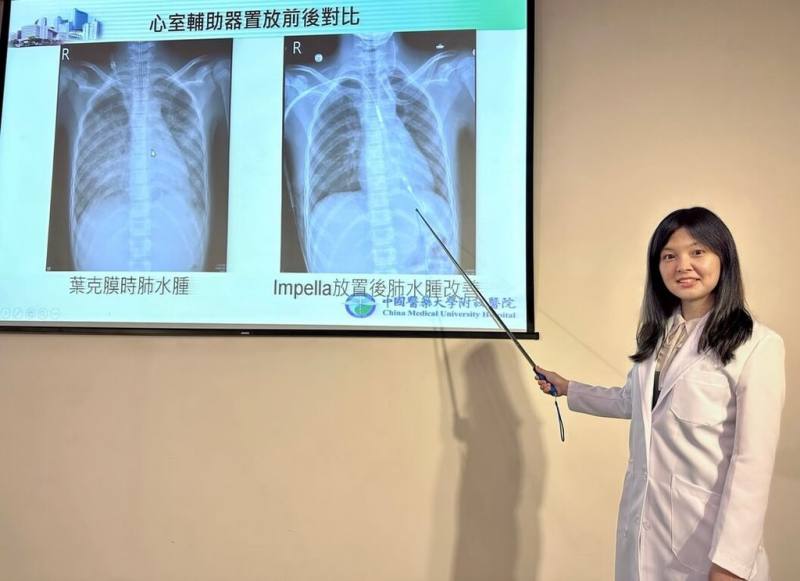台中13歲少女突發猛爆性心肌炎而休克，中國醫藥大學附設醫院心臟血管外科醫師吳佳穎（圖）說明個案症狀，與使用微型心臟幫浦搶救過程。（中醫大附醫提供）