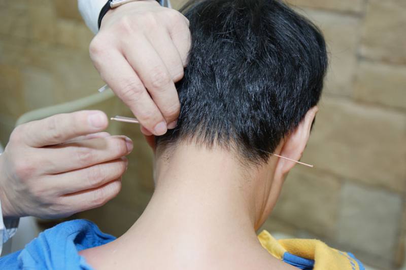 One of the defining features of healthcare in Taiwan is the combination of Western and Traditional Chinese Medicine (TCM). TCM not only can treat symptoms, it can deal with conditions at their source. The photo shows acupuncture therapy. (Ministry of Fore