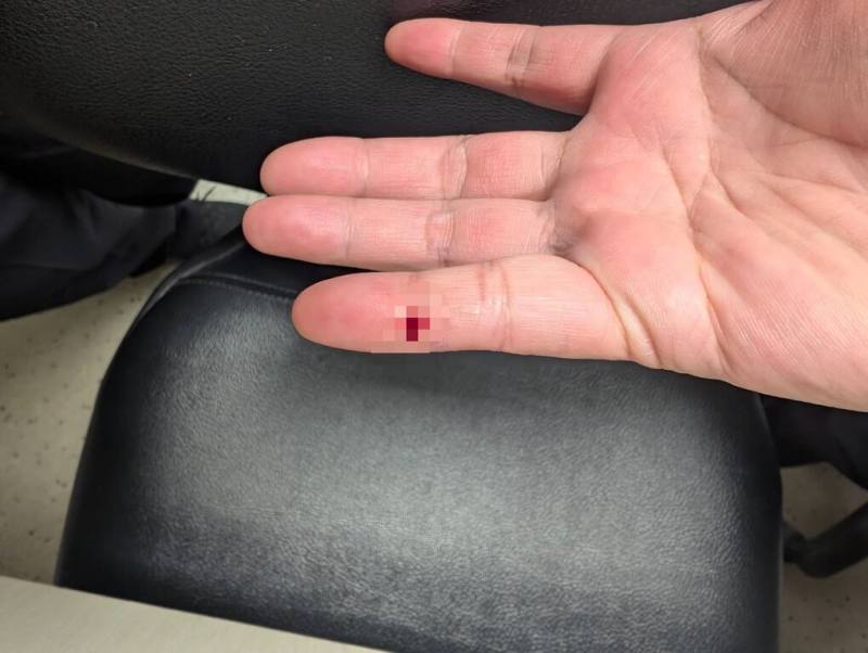 民進黨桃園市議員黃瓊慧28日指出，一名桃園機場檢疫人員日前被疑似同事亂丟在垃圾袋、抽過旅客血液的針頭扎傷流血。（黃瓊慧提供）