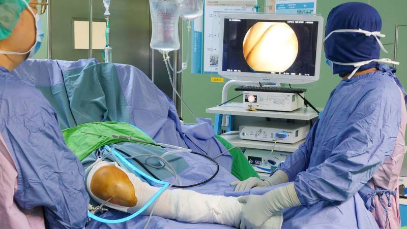 大林慈濟醫院骨科部引進「自體軟骨修復手術」，擷取膝蓋退化病人自身健康軟骨組織，透過特殊載體植入受損部位促進新軟骨生長。（大林慈濟醫院提供）