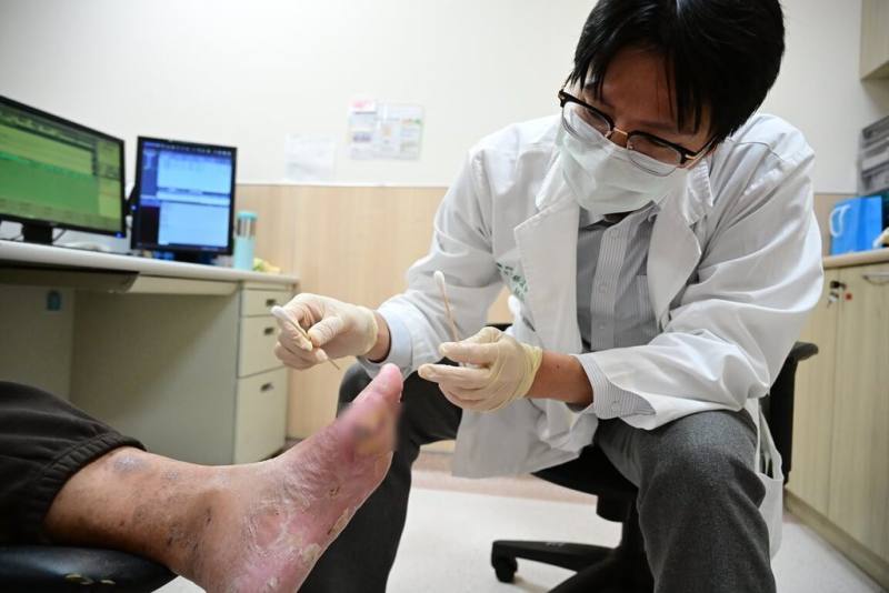 台中林姓男子患有三高並未服藥控制，日前出差時步行一整天，脫襪後發現腳皮幾乎剝落，醫師細心為清創後的糖尿病足潰瘍患者換藥，總算免於面臨截肢之苦。（亞洲大學附屬醫院提供）