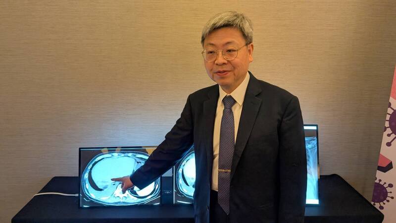 新竹台大分院副院長盛望徽（圖）7日指出，曾收治1名6旬老翁因腸胃道出血併發肝膿瘍感染，期間3度住院、歷時3個多月，使用6、7種抗生素治療卻反覆復發，醫療團隊發現老翁感染的是具金屬內醯胺酶（MBL）多重抗藥性機制的腸桿菌