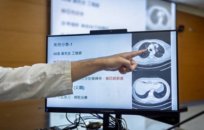 成大醫院內科部醫師指出，肺癌初期多半沒有明顯症狀，許多病患等到咳血、呼吸困難、頭痛或骨頭疼痛等明顯警訊時才就醫，通常已是肺癌晚期，高風險族群應定期檢查。（成大醫院提供）