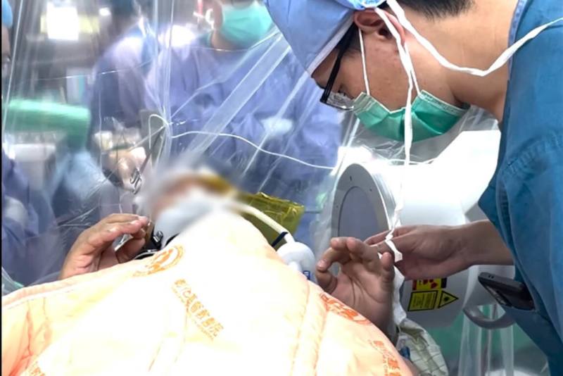 鄭姓男子罹患帕金森氏症多年，最近因藥物等嚴重干擾日常生活，彰化基督教醫院評估後決定執行深部腦刺激手術，在患者清醒狀態下執行關鍵步驟，以利即時觀察電極植入效果與臨床反應。（彰化基督教醫院提供）