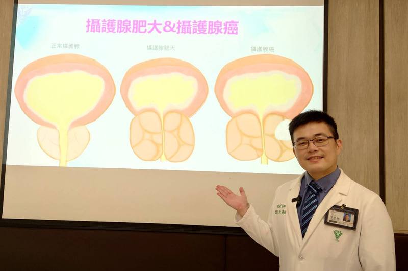 奇美醫院泌尿外科主治醫師曾文歆（圖）24日在院內衛教宣導會表示，攝護腺癌最可怕是太晚發現，若未提高警覺，確診時往往已進展到較晚期。