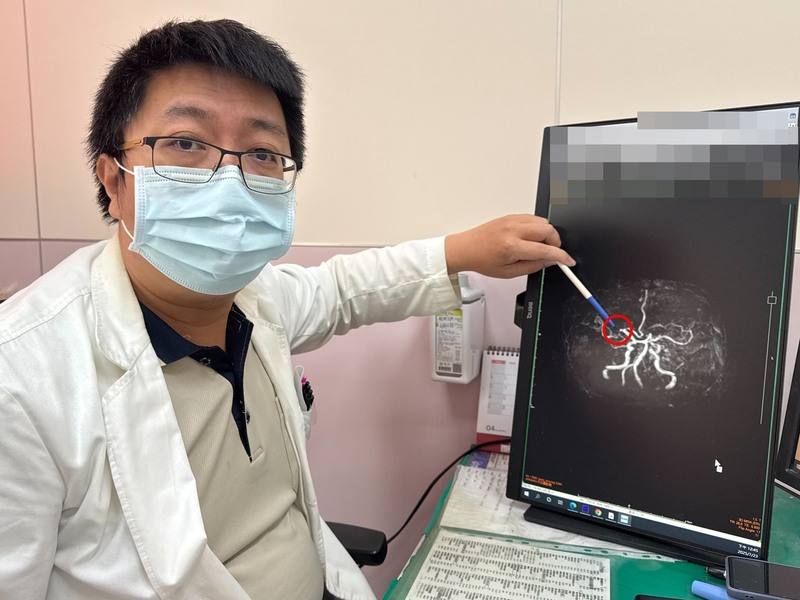 一名70多歲老翁在田裡昏倒，送醫檢查診斷為暫時性大腦缺血，是中風的前兆。大甲李綜合醫院神經內科醫師張峻誠（圖）指出，患者右中大腦動脈有阻塞現象