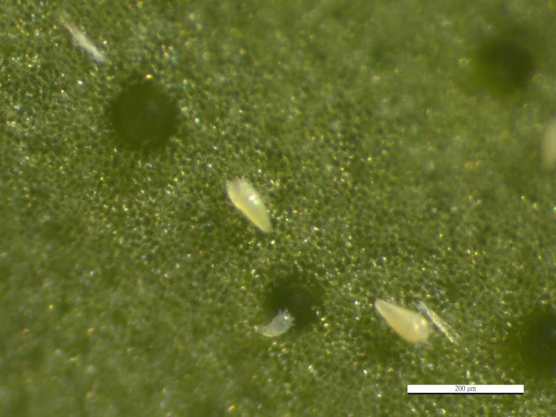 在顯微鏡下之柑橘銹蜱成蟲