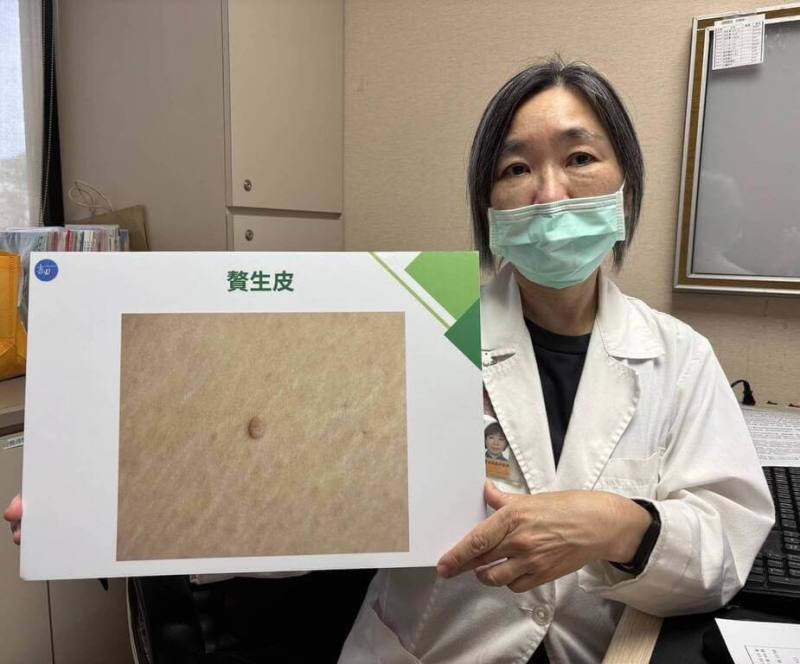 書田診所整形美容科主任醫師黃季怡（圖）說，贅生皮紅腫疼痛建議積極治療，以免引起併發症或留下疤痕，發現身上有凸起物、腫塊，最好就醫檢查確認病因。 （書田診所提供）