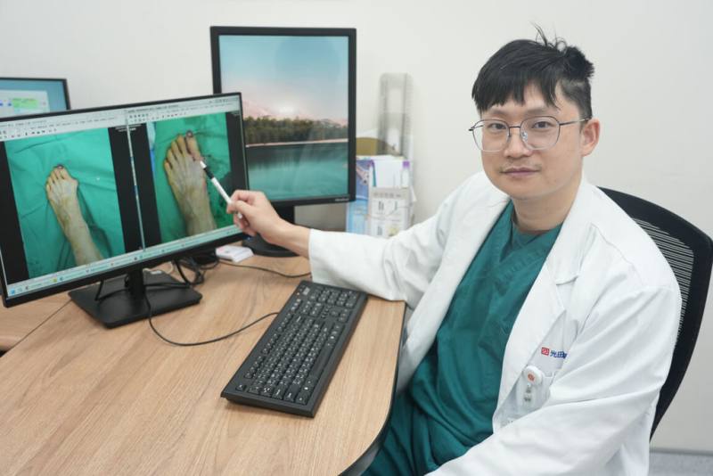 光田綜合醫院骨科醫師洪煒竣指出，拇趾外翻如拖太久治療，最後恐致關節炎風險（光田綜合醫院提供）