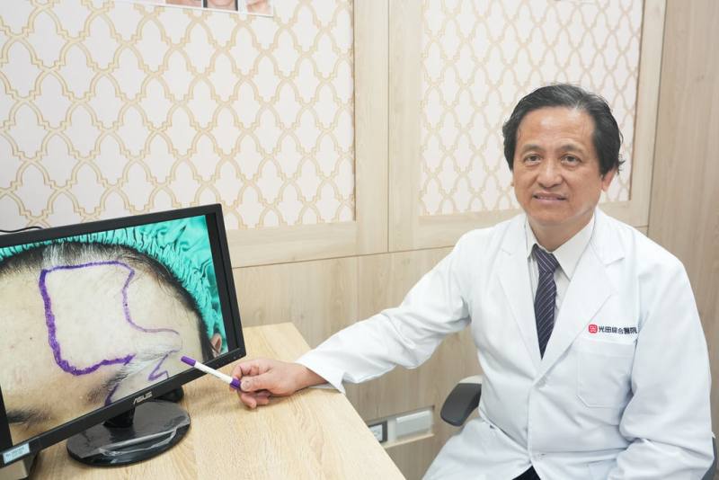 光田綜合醫院整形外科主任吳文宏指出，王男左額膚色越來越淡，以為曬太陽可改善，未料更加明顯；吳文宏說，白斑症是因免疫系統異常，導致黑色素細胞受損或缺失的疾病，以「黑色素顯微移植」方式可改善。（光田綜合醫院提供）