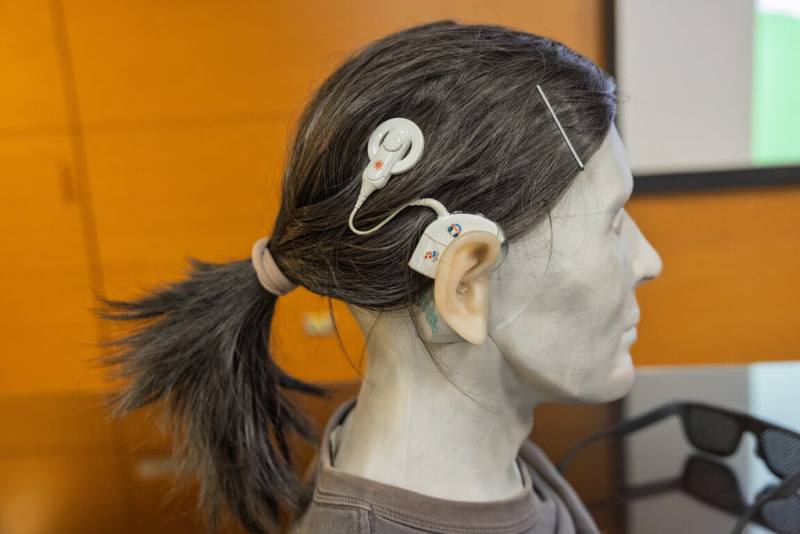 成大醫院8日表示，臨床上輕中度聽力損失主要採用助聽器作為介入輔具；植入人工耳蝸則是重度聽力損失者另一項介入選擇，可將聲音轉換為電訊號，直接刺激聽神經。圖為人工耳蝸示範用品。（成大醫院提供）