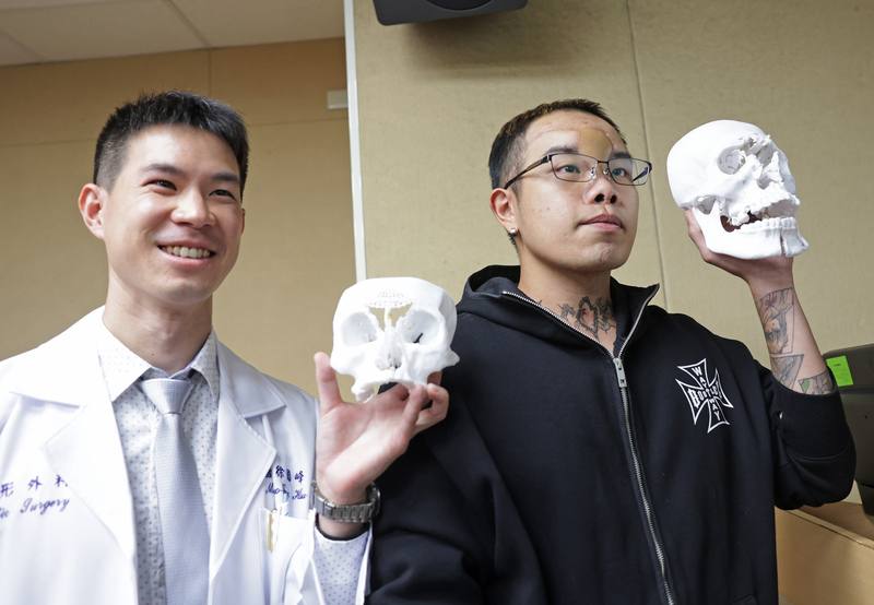 三軍總醫院日前接獲遭槍傷導致臉骨粉碎、腦部直接暴露的患者，醫療團隊透過3D列印模型輔助手術規劃，成功讓患者重獲自然五官比例，26日舉行記者會發表，整形外科主治醫師徐國峰（左）與顱顏重建患者開心合影