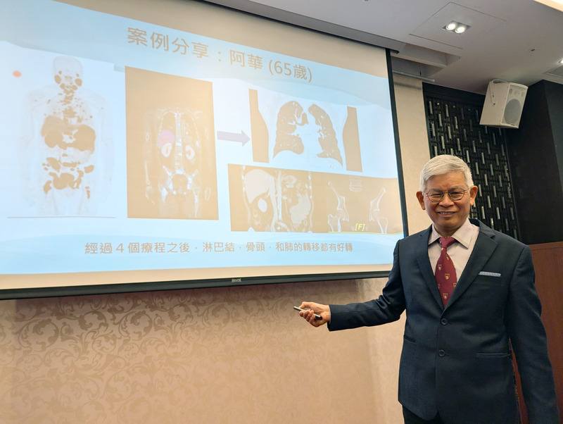 泌尿腫瘤關懷協會理事長歐宴泉（圖）28日在衛教記者會指出，病友「阿華」接受攝護腺特異性膜抗原正子造影（PSMA），因而找到適合的精準放射標靶治療，大幅減輕疼痛感並控制病情。