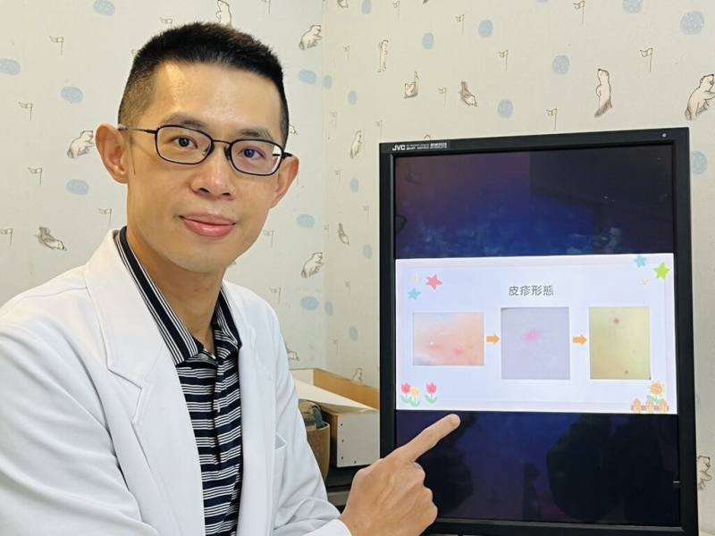 書田診所小兒科主任醫師蘇軏提醒，除皮疹外，水痘症狀還有發燒、倦怠等，傳染力極強，且若成人感染恐比孩童更嚴重。（書田診所提供）