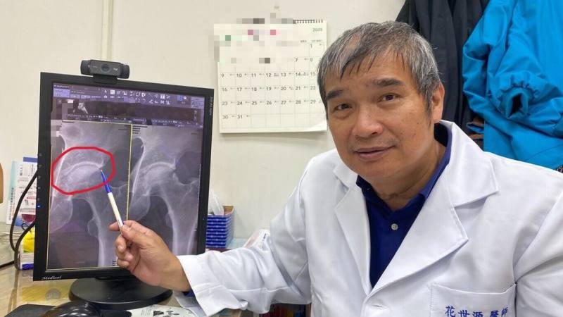 員榮醫院骨科醫師花世源（圖）19日分享個案指出，從事裝潢工作葉姓男子，工作常需蹲下，後來發現走路時沒問題，但只要蹲下時，關節就會痛到受不了，經診斷罹患了髖關節夾擊症候群。（員榮醫院提供）