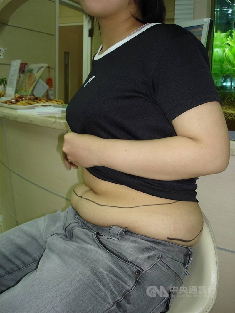 圖為肥胖示意圖。中央社檔案照片