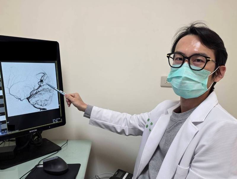 苗栗縣大千醫院神經放射科醫師康靜維（圖）20日指出，一名女子因突發劇烈頭痛掛急診，進一步檢查為罕見「顱內動靜脈畸形」引發出血，所幸及時治療止住出血，成功化解危機。（大千醫院提供）