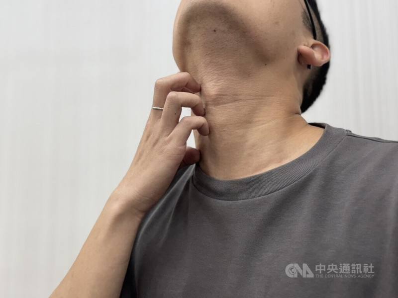 隨著清明節氣來臨，氣候由乍暖還寒逐漸轉為溫暖潮濕，中醫師指出，此時正是皮膚問題好發季節，尤其是濕疹、異位性皮膚炎、皮膚搔癢等症狀。