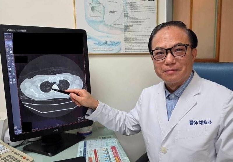 苗栗縣56歲人婦長期咳嗽不見好轉，就醫透過低劑量電腦斷層（LDCT）揪出早期肺癌，經微創手術治療後恢復良好。大千綜合醫院醫師謝為忠（圖）提醒，高風險族群可多利用政府提供每2年1次的公費LDCT篩檢。（大千醫院提供）