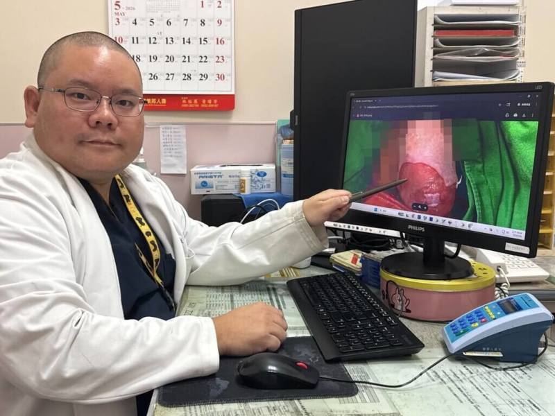 一名婦人子宮脫垂15年，日前因尿液逆流，引起腎臟炎而發燒到院治療，李綜合醫院泌尿科醫師黃品叡（圖）說明，婦人因子宮脫垂把膀胱拉出，導致尿尿排不乾淨甚至逆流，經手術摘除子宮，緩解不適。