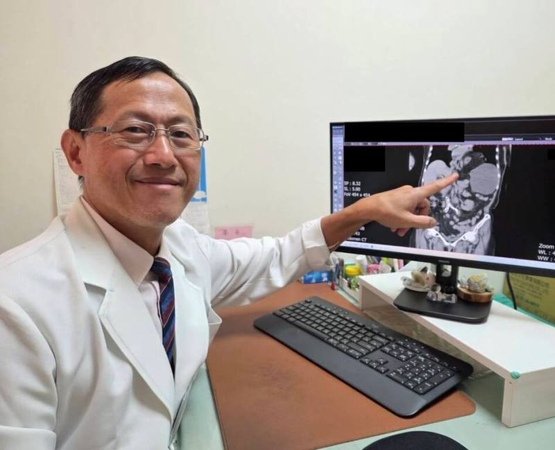 苗栗縣85歲婦人就診查出橫結腸脫位竄入左側胸腔。大千綜合醫院外科部主任馮啟彥（圖）19日說，橫膈膜疝氣多由外傷壓力引起，婦人完全沒有外傷史的「自發性橫膈膜疝氣」，在臨床上非常罕見。（大千醫院提供）