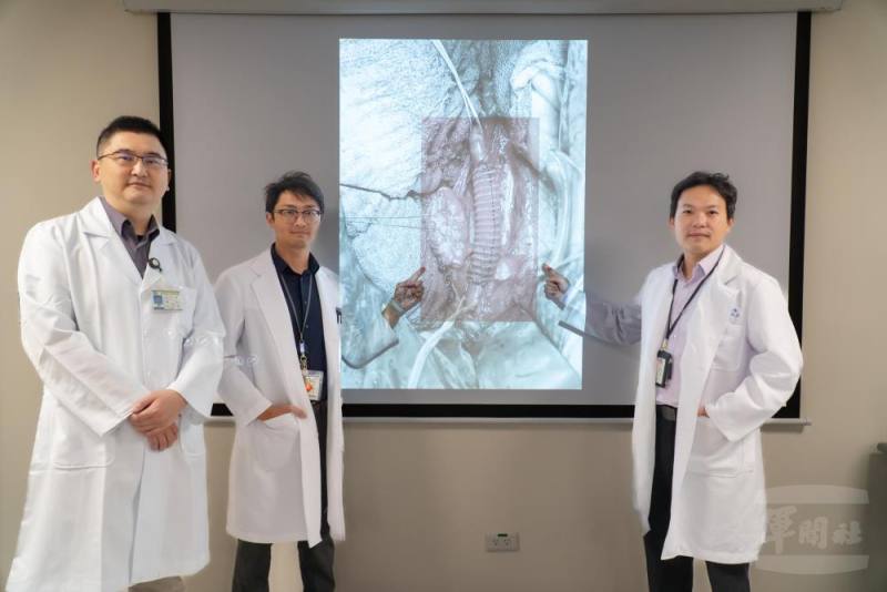 國軍臺中總醫院跨科合作成功完成高難度腹腔腫瘤切除與重建手術。（國軍臺中總醫院提供）