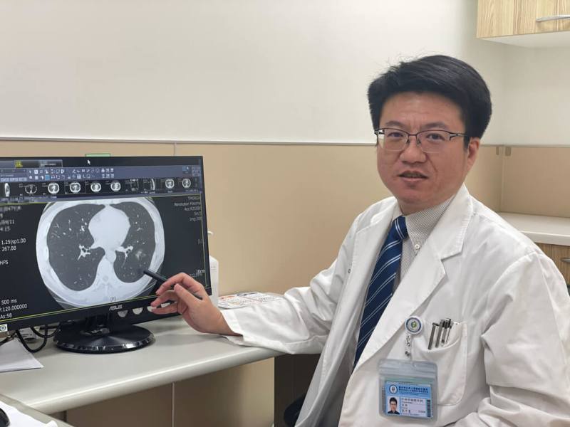 台中市立老人復健綜合醫院胸腔外科主任張平憲（圖）14日表示，1名47歲男子已戒菸4年，健檢發現左下肺有約2.4公分肺結節，病理檢查證實為第1期肺腺癌。（醫院提供）